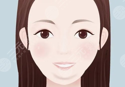 瑞蓝丽堤玻尿酸怎么样？