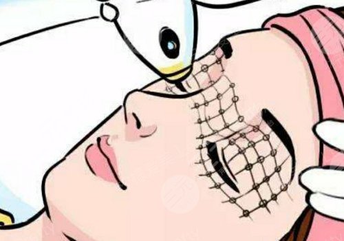 热玛吉的原理和功效是什么？