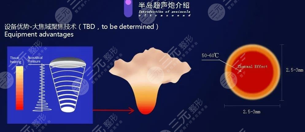 超声炮有什么效果和副作用