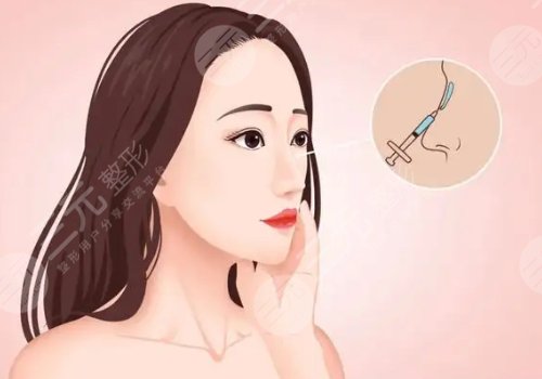 宝尼达隆鼻可以维持多久？
