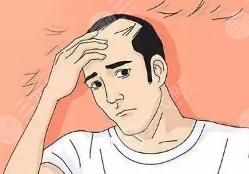 纹发和植发哪个效果好？