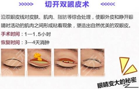 双眼皮