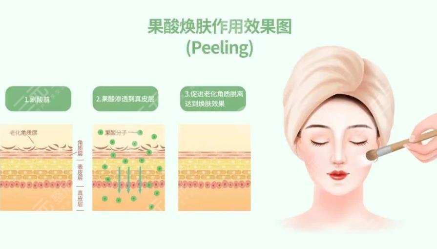 果酸换肤