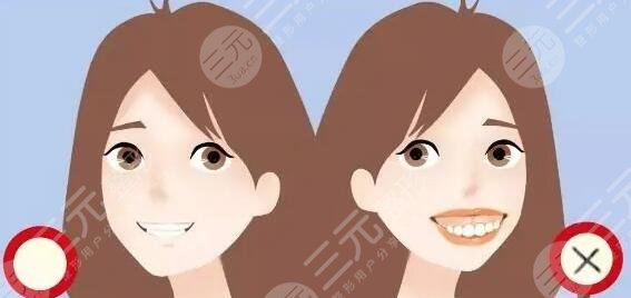 牙齿矫正术后护理