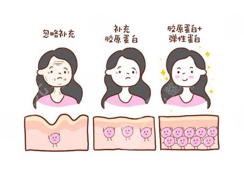  双美胶原蛋白有几种型号？