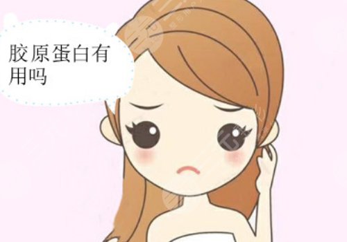  双美胶原蛋白有几种型号？