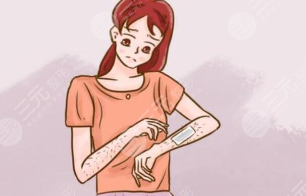 脱毛