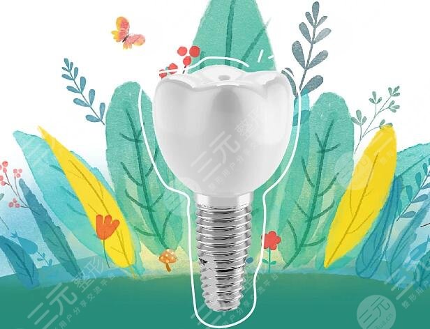 种植牙项目注意事项