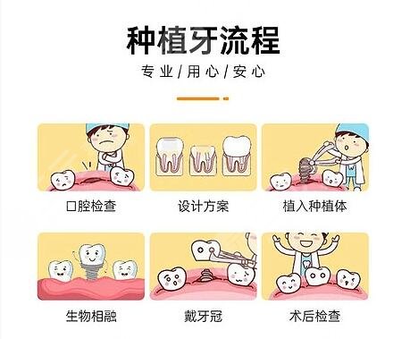 牙种植体植入后几天可以咀嚼食物?