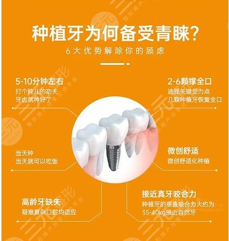 牙种植体植入后近期应注意什么?