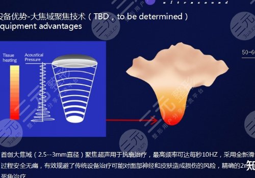 热玛吉和超声炮哪个效果好？
