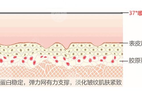 热玛吉和超声炮哪个效果好？