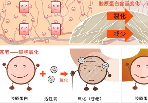 热玛吉和超声炮哪个效果好？