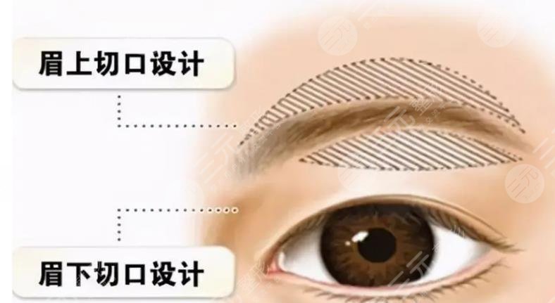 提眉
