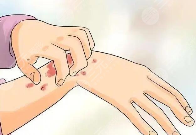皮肤瘙痒起红疙瘩是什么原因导致的？应该怎么防治及解决皮肤瘙痒的问题？