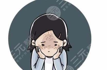 黄褐斑