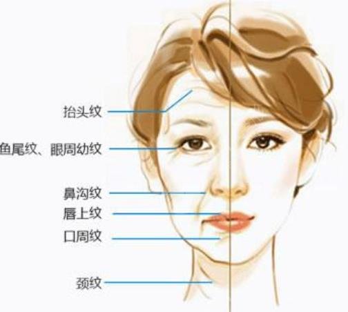 除皱