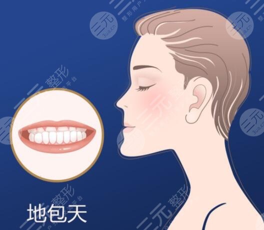 地包天矫正后脸型会有变化吗?