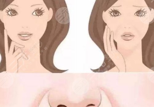 欧洲之星的功效作用及副作用汇总