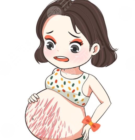 妊娠纹产生的原因