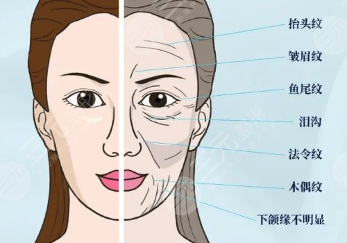 欧洲之星和超声炮哪个好？