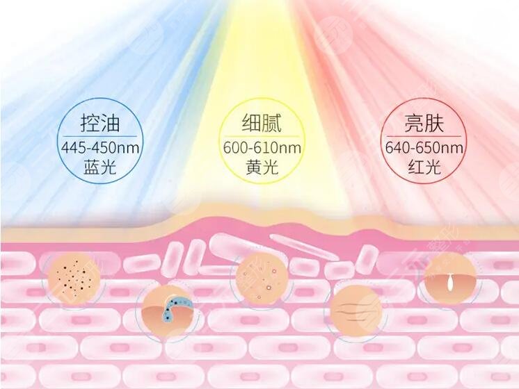 光子嫩肤的注意事项