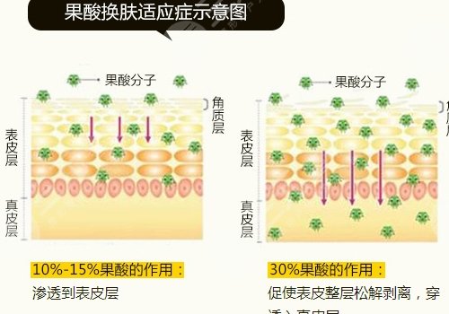 热玛吉有什么效果和副作用有哪些？