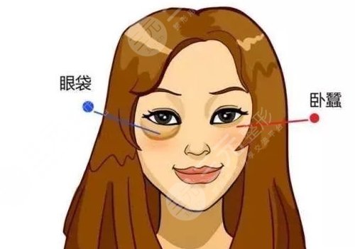 双美胶原蛋白填充泪沟能维持多久?