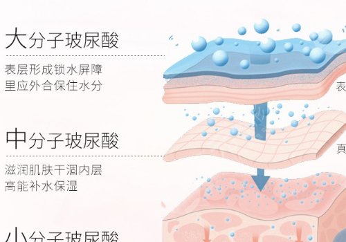 公主玻尿酸适合打哪里?