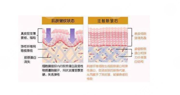 注射胶原蛋白有什么作用
