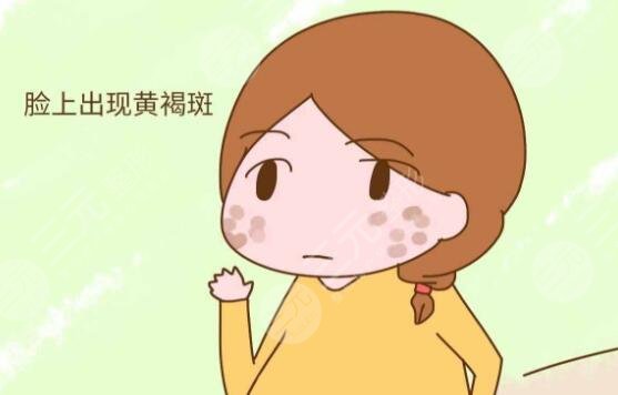 激光治疗黄褐斑注意什么?