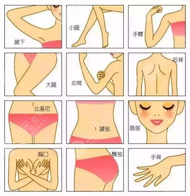 冰点脱毛和激光脱毛的区别