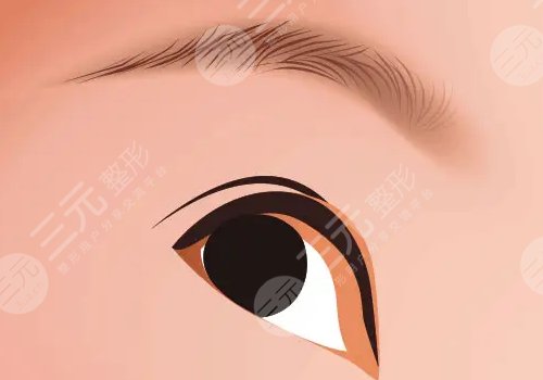 割双眼皮有什么危害或者后遗症?