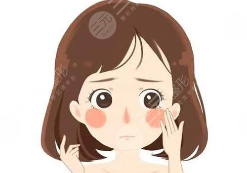 苹果肌复位术怎么做？