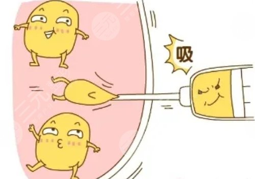 腹部吸脂肪有什么后遗症?