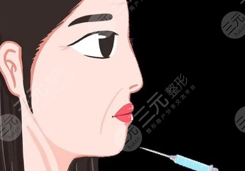 玻尿酸填充脸部可以维持多久?