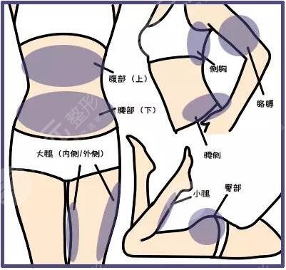 吸脂减肥的注意事项