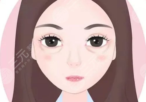 泪沟填充用什么方法好？