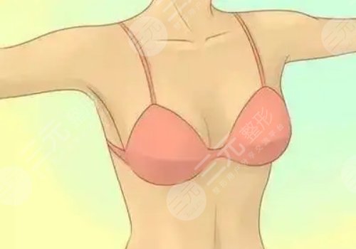 乳房整形手术一般多少钱?