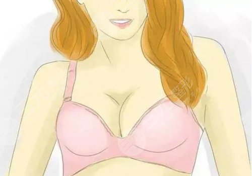 乳房整形手术一般多少钱?