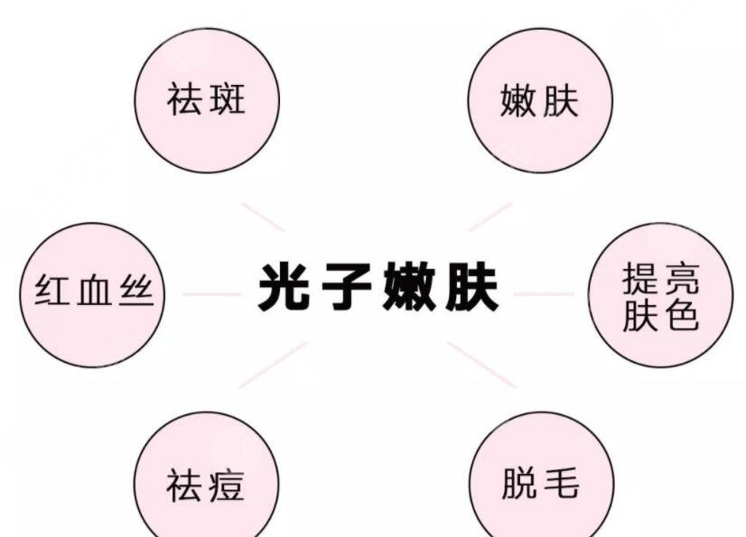 光子嫩肤是什么原理呢?