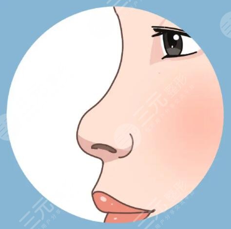 膨体隆鼻的副作用有哪些？手术风险大吗？注意事项该是什么？