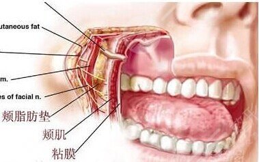 去颊脂垫的原理?是什么?