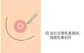 乳晕大