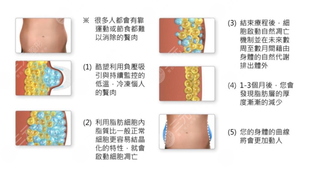 溶脂减肥的效果和副作用有哪些？