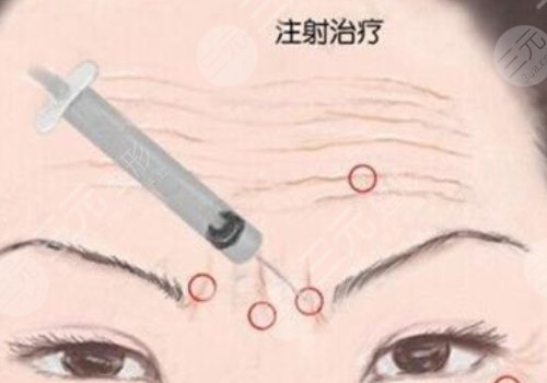 瑞兰2号玻尿酸多少钱？