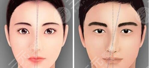 歪鼻矫正的手术功效