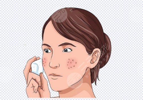 脸上皮肤粗糙毛孔粗大怎么才能恢复得好？