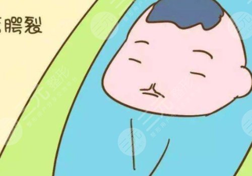 治疗兔唇的费用大概是多少?