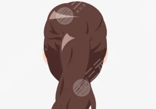 小圆脸适合什么发型？